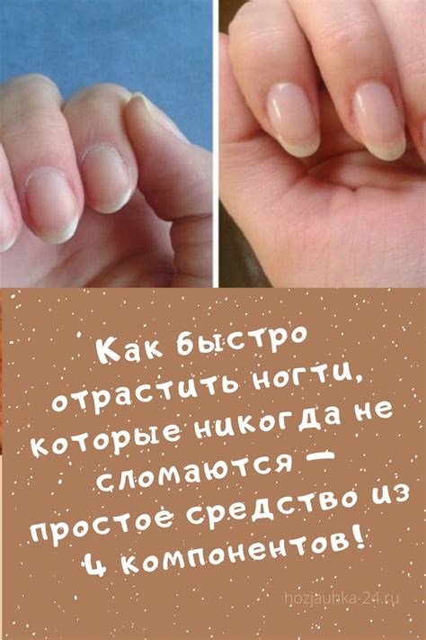 Как быстро отрастить ногти на ногах: 15 шагов